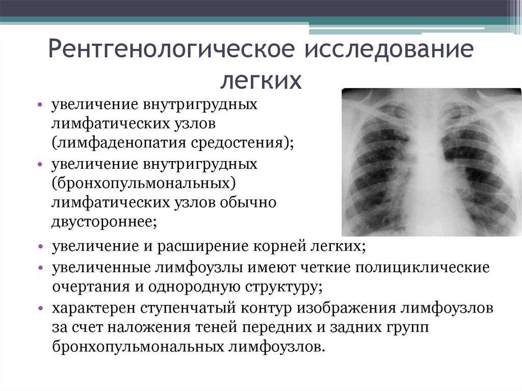 Пневмония у детей - симптомы, виды, диагностика и лечение | детская пульмонология см-клиники в спб