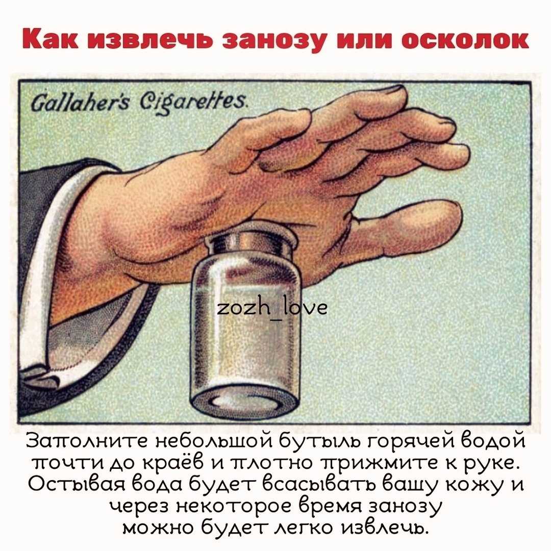 Заноза - как безболезненно извлечь? как вытащить при помощи иголки или пинцета? мази для извлечения занозы