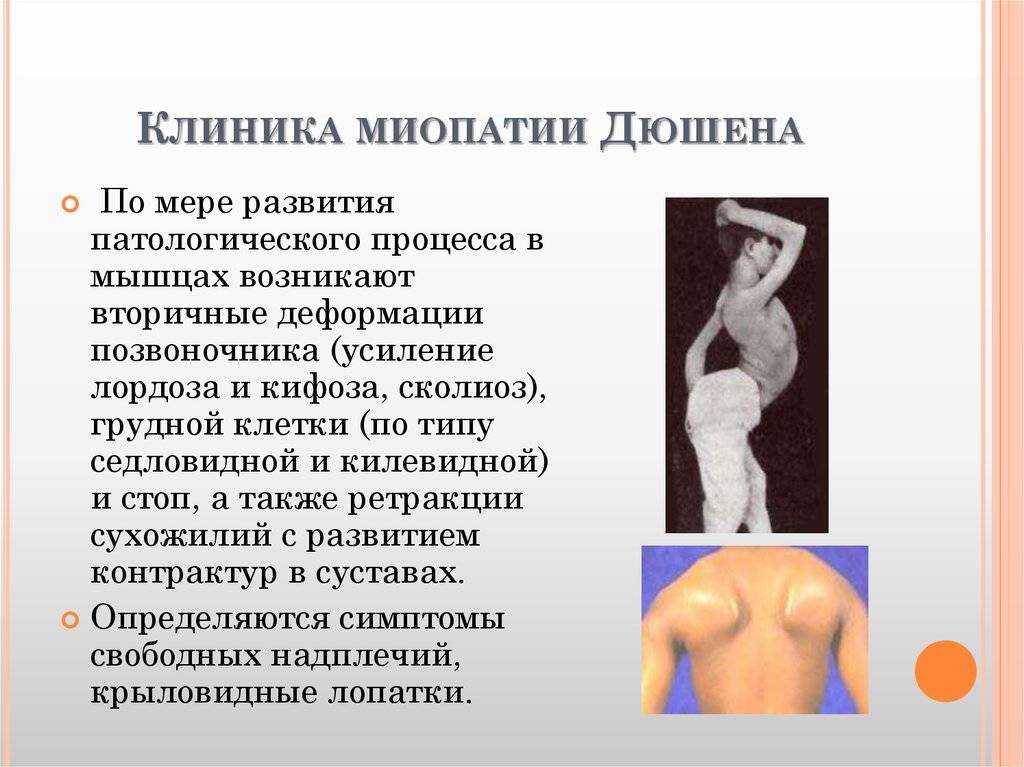 Ветрянка у детей