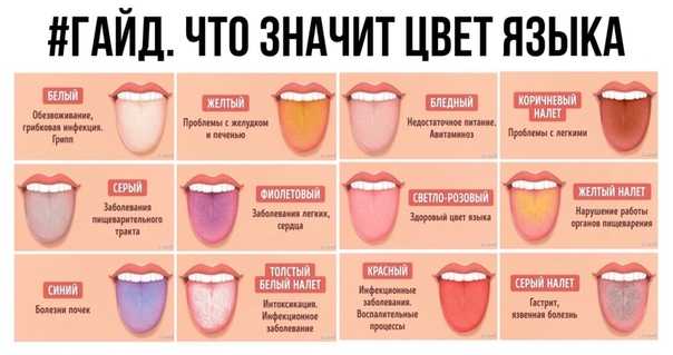 Красные точки во рту у ребенка: причины, локализация сыпи, симптомы и лечение