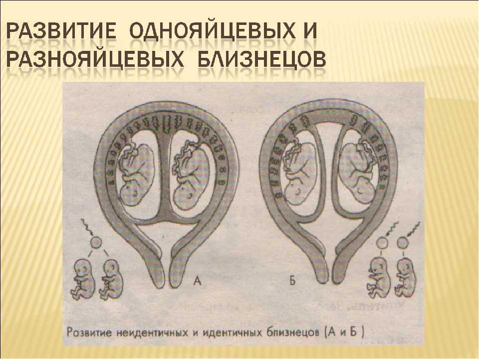 Что показывает узи у беременных двойней. основные причины рождения двойни