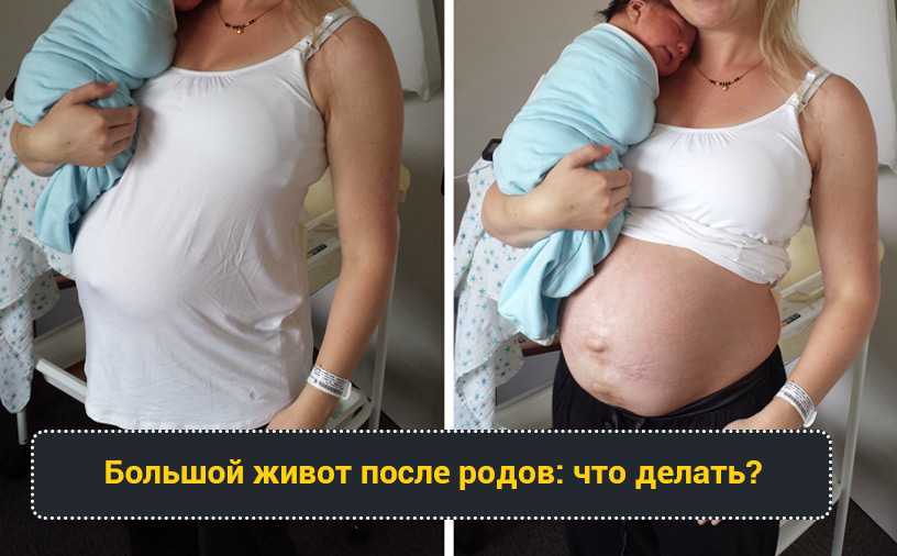 Изменения в организме при беременности