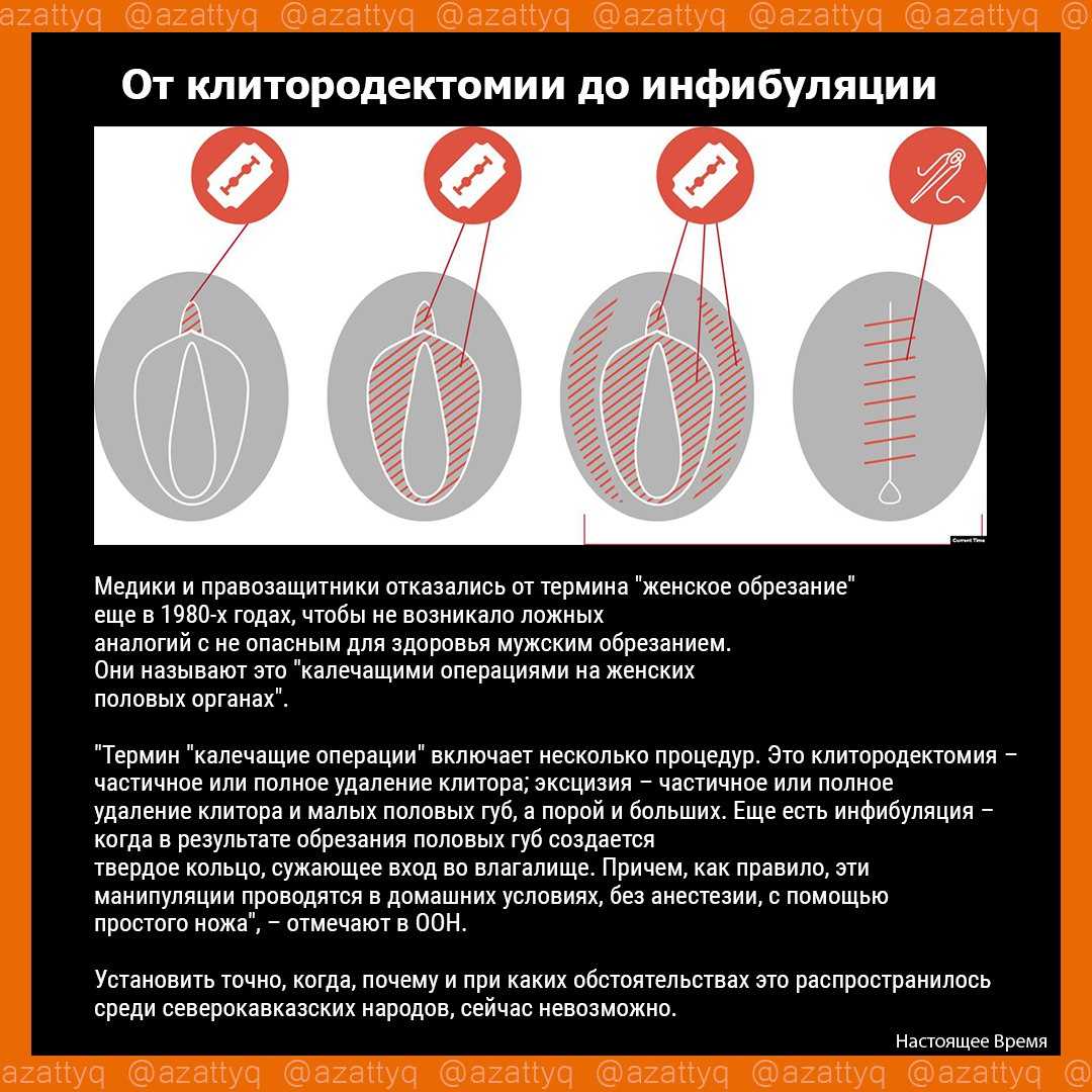 Все про обрезание у мужчин: зачем и как делают, схемы, сколько стоит