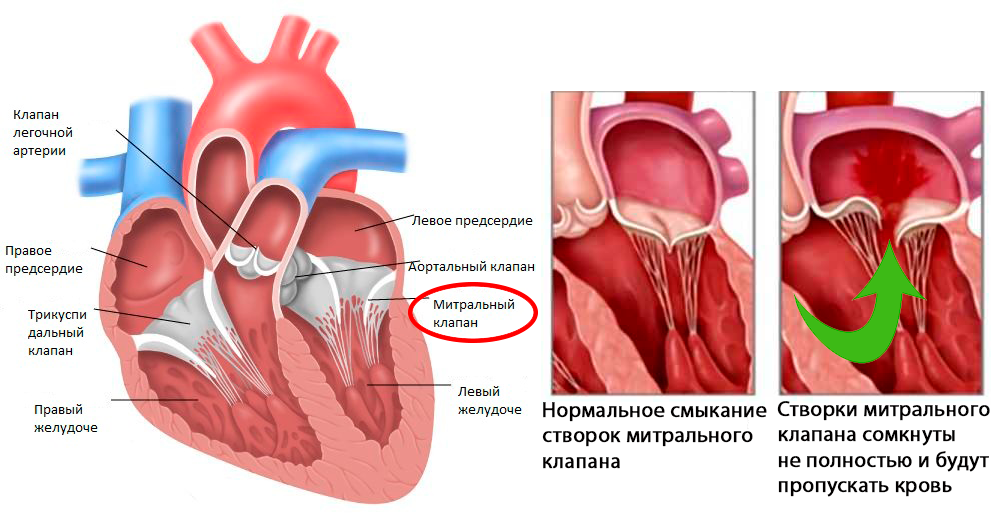 Анатомия митрального клапана сердца. Митральный клапан это клапан. Анатомия клапана легочной артерии. Недостаточность клапана регургитация.