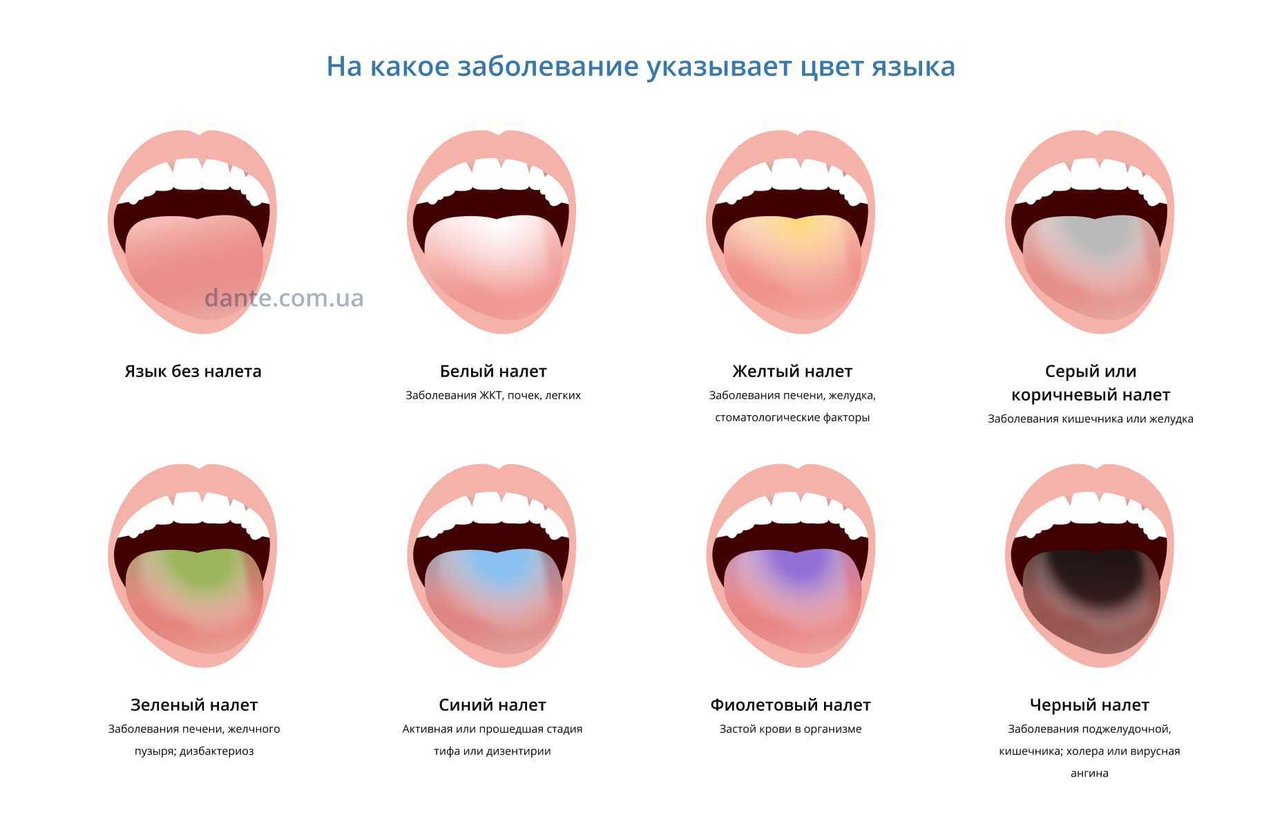 Удаление налета пристли, или как с детства не бояться стоматологов