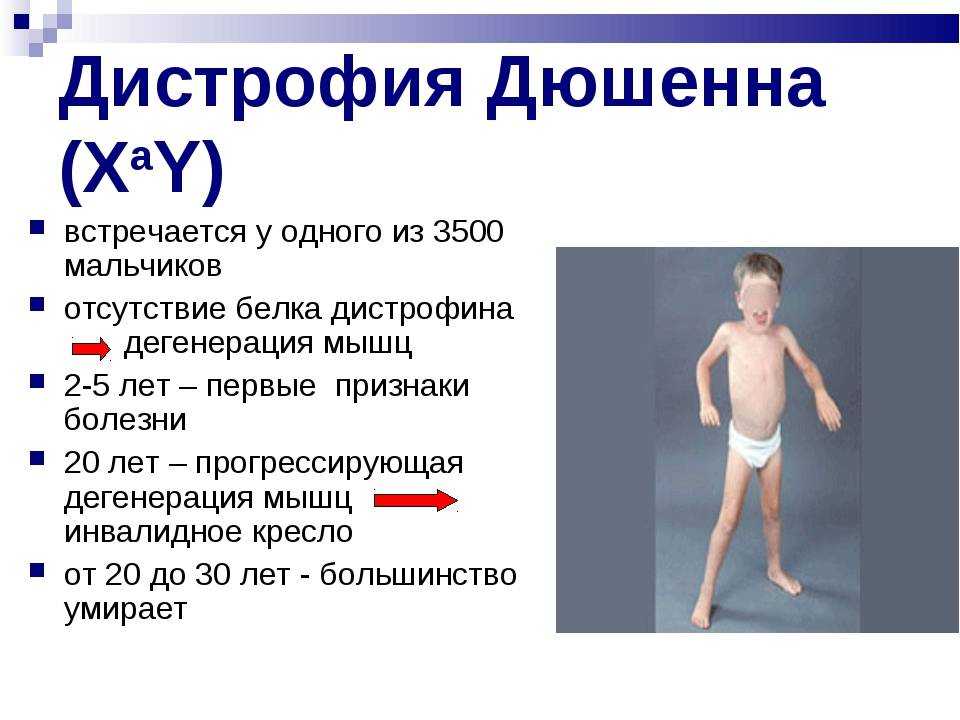 Лечение дистрофии у детей