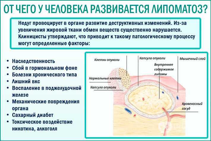 Удаление жировика на веке глаза лазером и радиоволновым способом в юнион клиник, спб