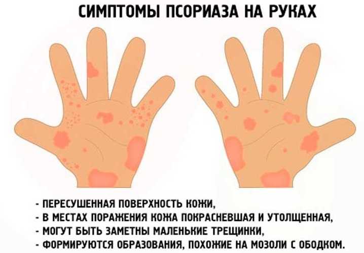 Кожные заболевания у детей (фото): описание, лечение и профилактика