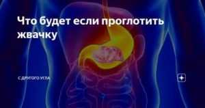 Что делать, если ребенок проглотил жвачку | еда карапуза