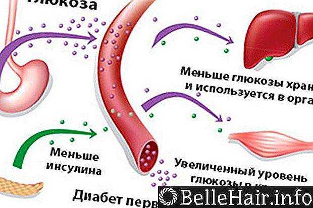 Дигидротестостерон
