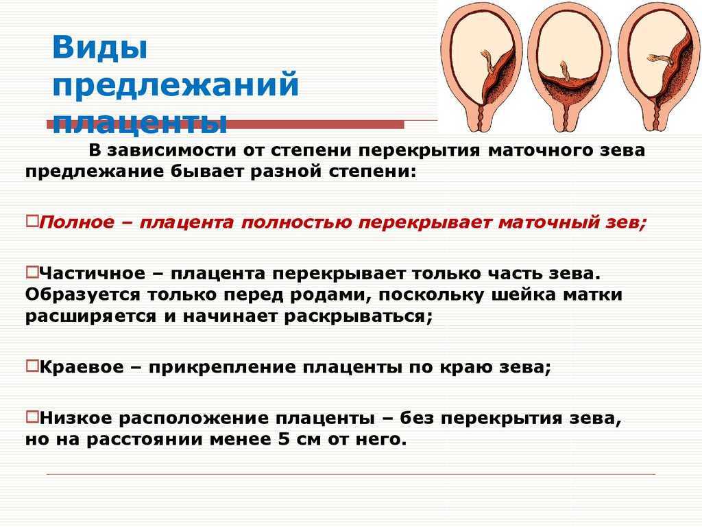 Предлежание плаценты (хореона): чем опасно такое состояние беременной. почему возникает и что делать при такой беременности? | азбука здоровья