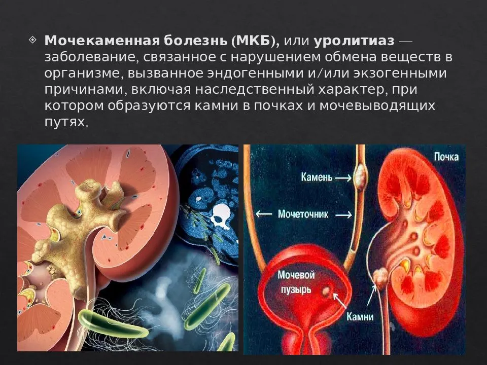 Как понять результаты анализа мочи?