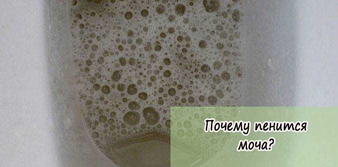 Белок в моче при беременности: норма и отклонения