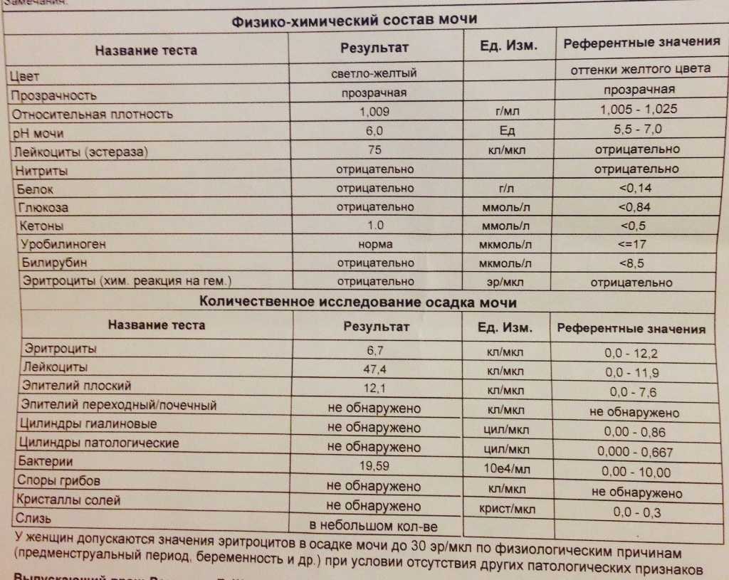 Лейкоциты в моче: причины повышения, как понизить