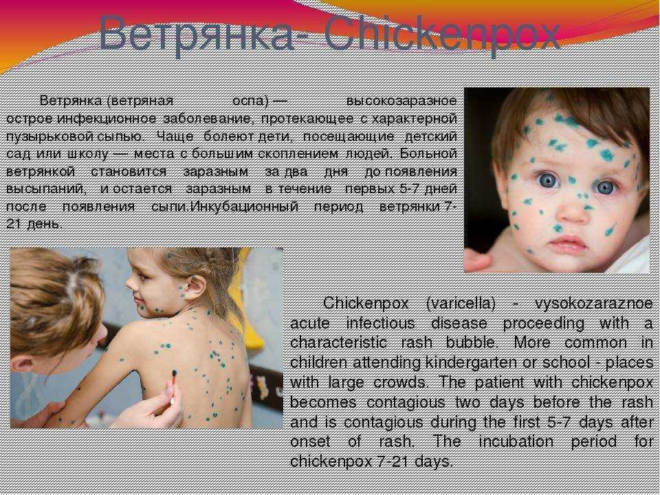 Можно ли гулять при ветрянке детям и взрослым: летом, без температуры, на улице, комаровский, на солнце, зимой
