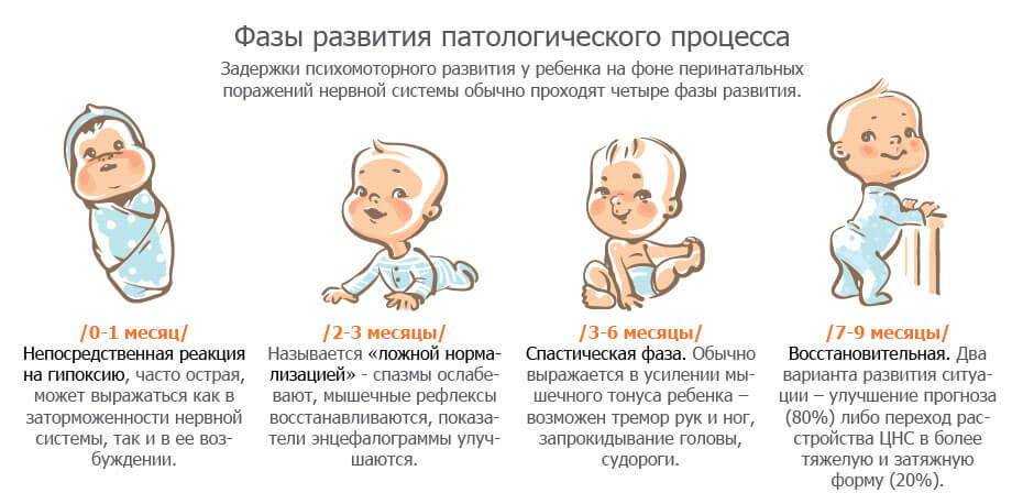 Гипоксически-ишемическое поражение цнс: причины перинатального поражения, симптомы, лечение