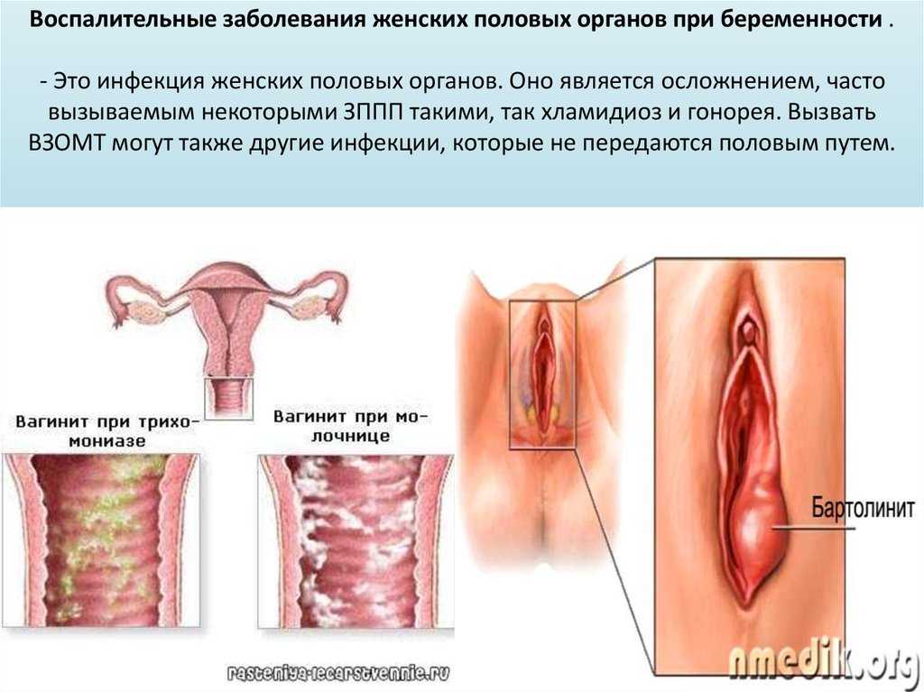 Удаление липом в интимной зоне — центр эстетической медицины
