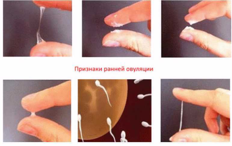 Выделения с запахом у женщин | университетская клиника