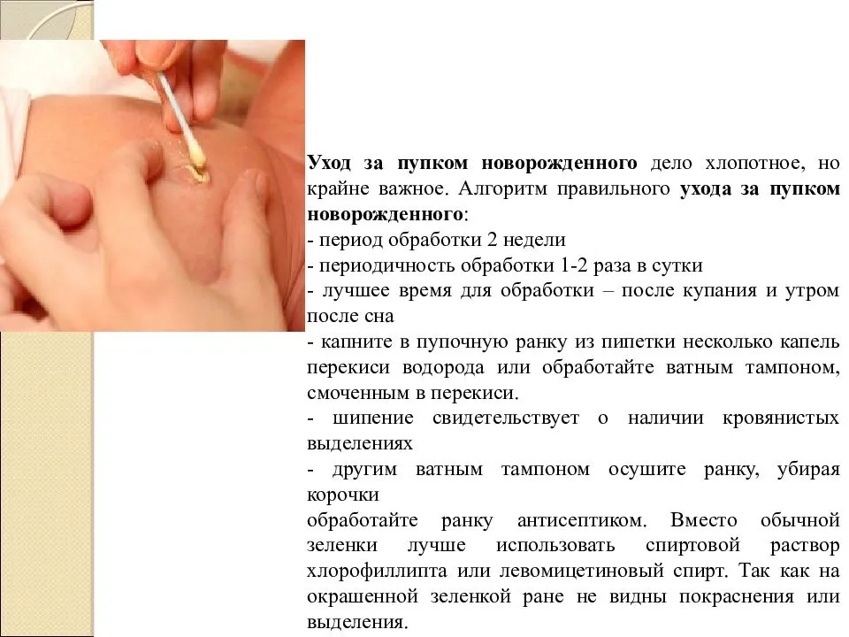 Как обрабатывать пупок новорожденного