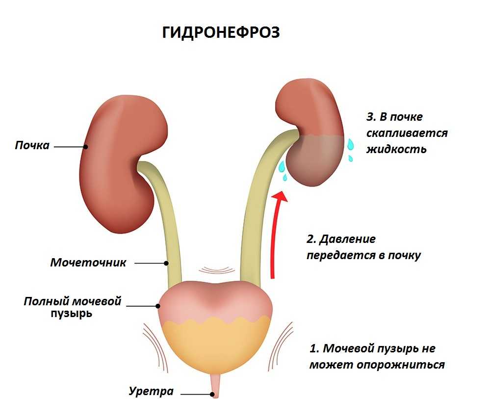 Патологии почек у плода: что и когда показывает экспертное узи при беременности * клиника диана в санкт-петербурге
