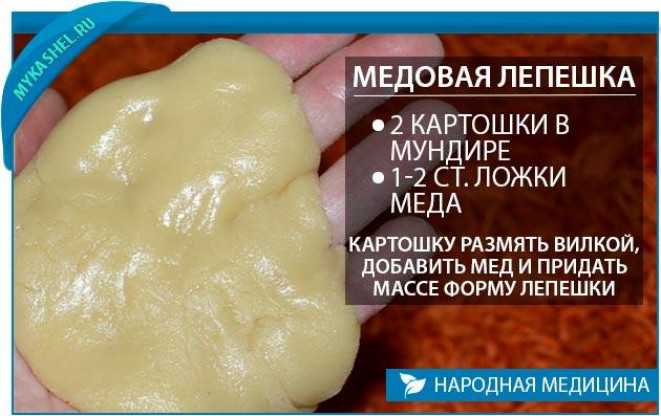 Как сделать медовую лепешку от кашля для детей: варианты рецептов с добавлением горчицы, муки и других компонентов