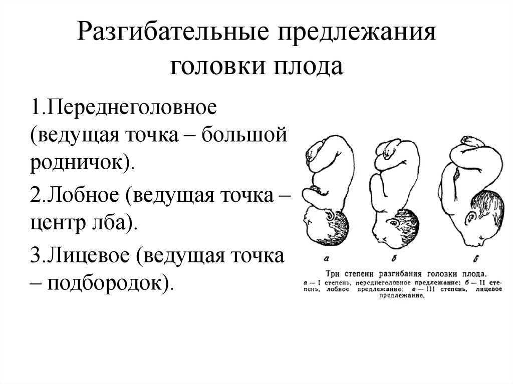 Тазовое предлежание плода: классификация, особенности, причины, ведение беременности и способы родов