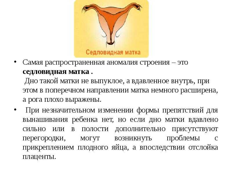 Седловидная матка и беременность: влияние на зачатие и вынашиваемость, позы для секса при патологии, хирургическое вмешательство