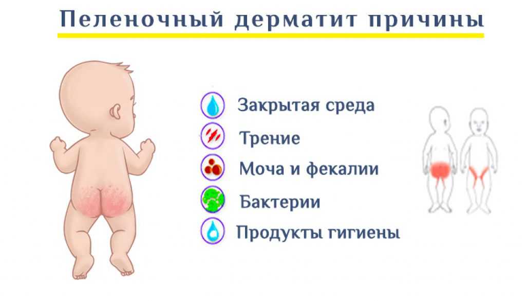 Потница