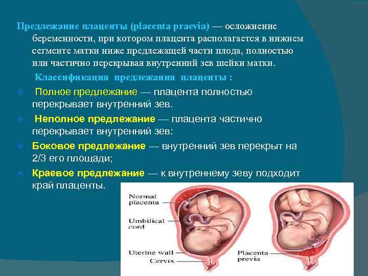 Что делать, если выявлена низкая плацентация при беременности