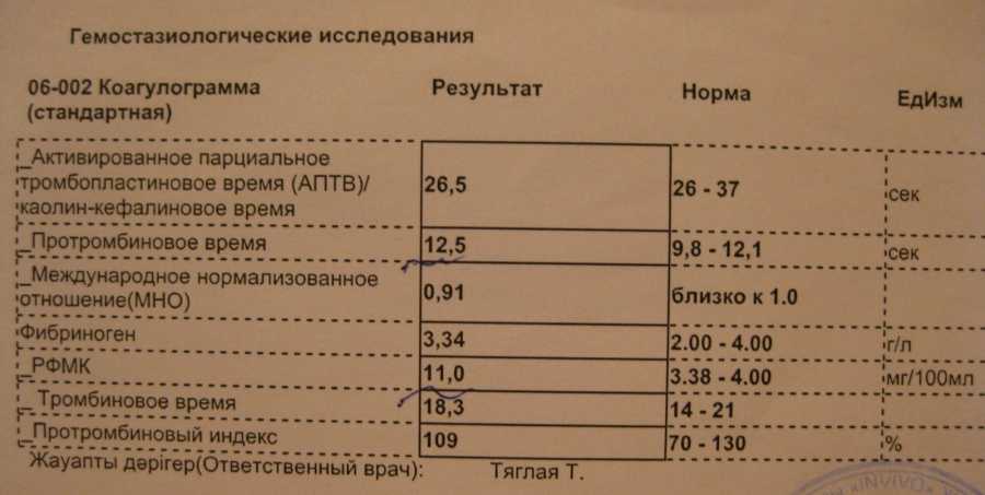 Анализ на свертываемость крови (коагулограмма)  – зачем проводится и что показывает