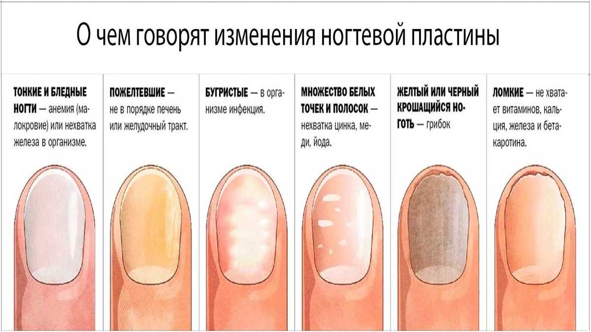 Патология ногтевых пластин