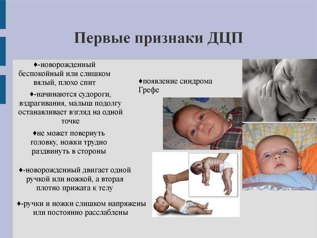 11 неделя беременности