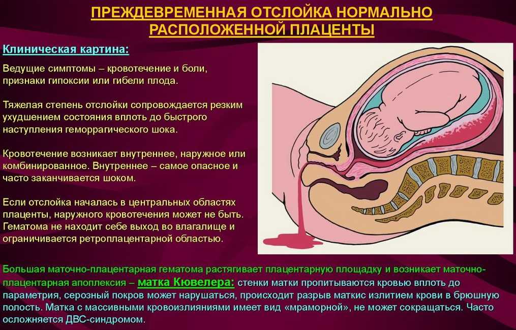 Можно Заниматься Сексом В Первый Триместр