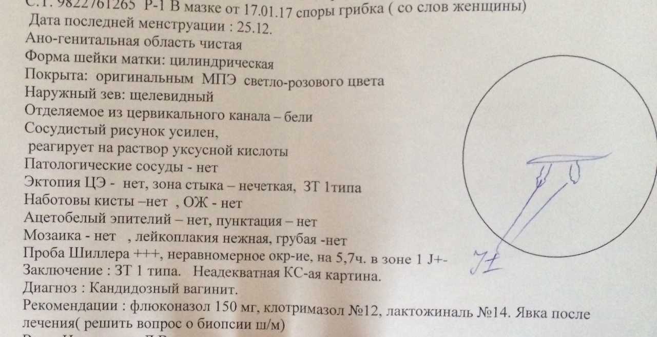 Игх при раке молочной железы