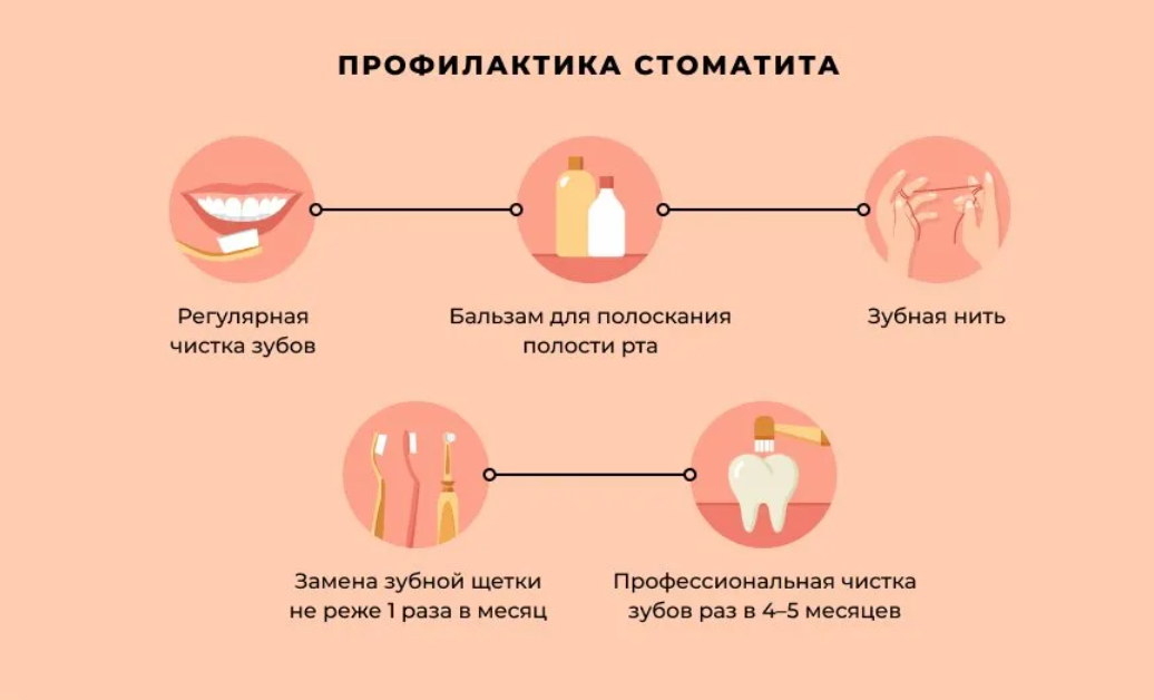 Чем лечить стоматит у взрослых. Профилактика стоматита. Стадии развития стоматита.