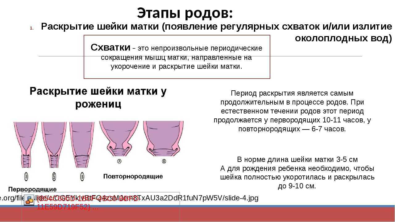 Слабость родовой деятельности