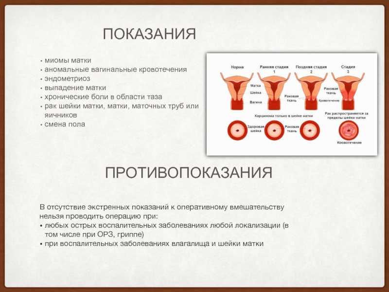 Ранние и поздние осложнения гинекологической хирургии: оценка в визуальных тестах