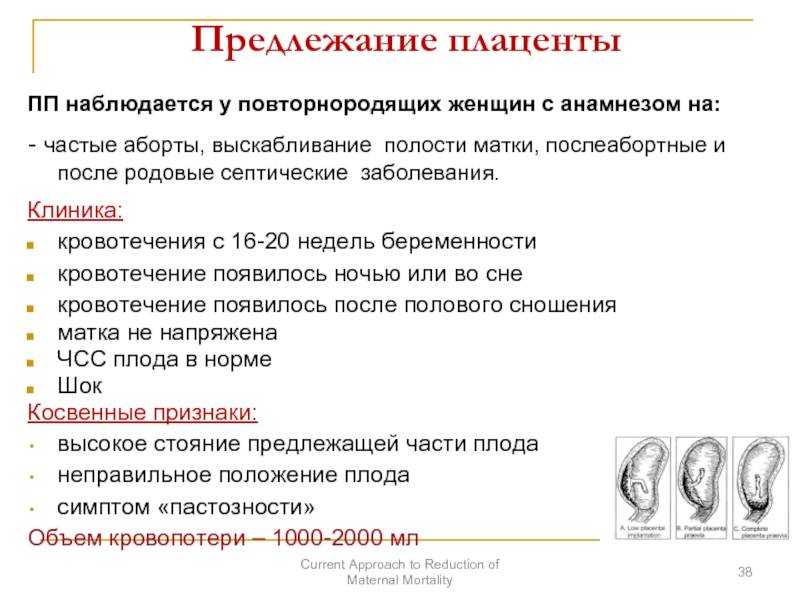 Чем грозит краевое, полное (центральное) предлежание плаценты и как эта патология беременности отражается на родах