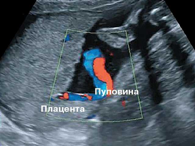 Пуповина плода: что это такое и как образуется, какой длины должна быть в норме и для чего нужна, как выглядит?
