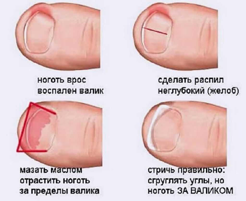 5 действенных способов, как убрать проблему желтых пальцев от сигарет из жизни курильщика