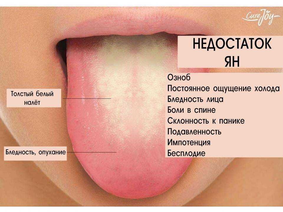 Стоматит