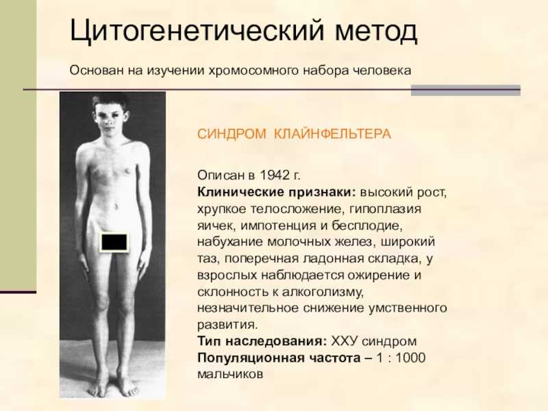 Синдром клайнфельтера — причины, признаки и лечение — med-anketa.ru