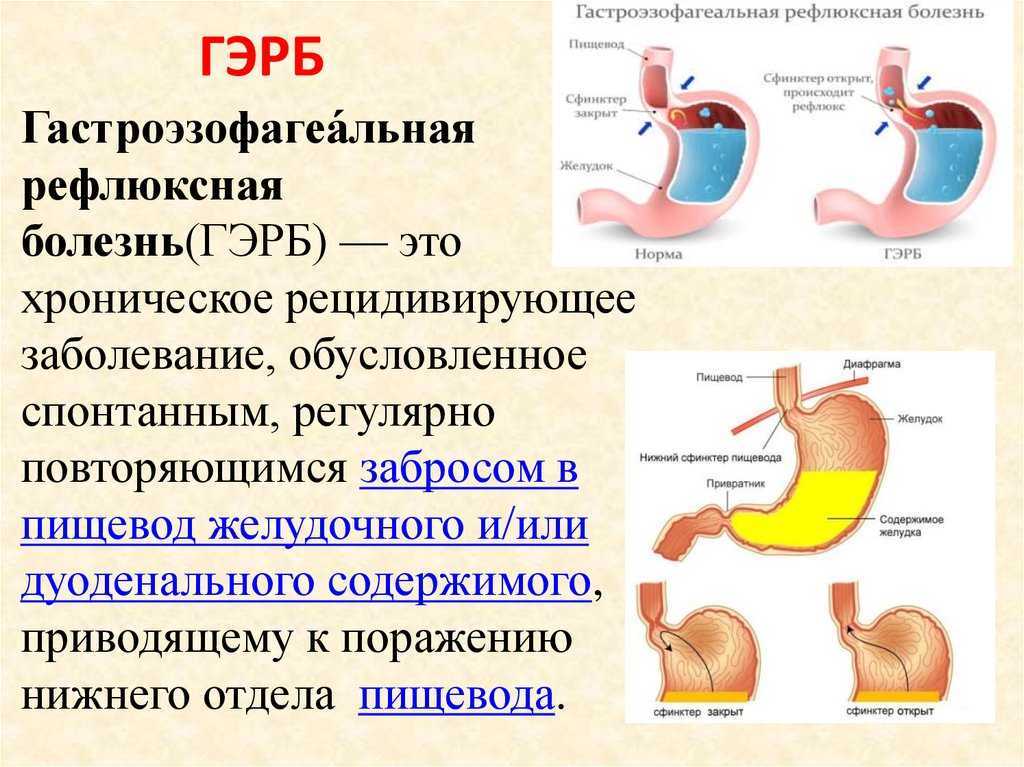 Срыгивания у ребенка