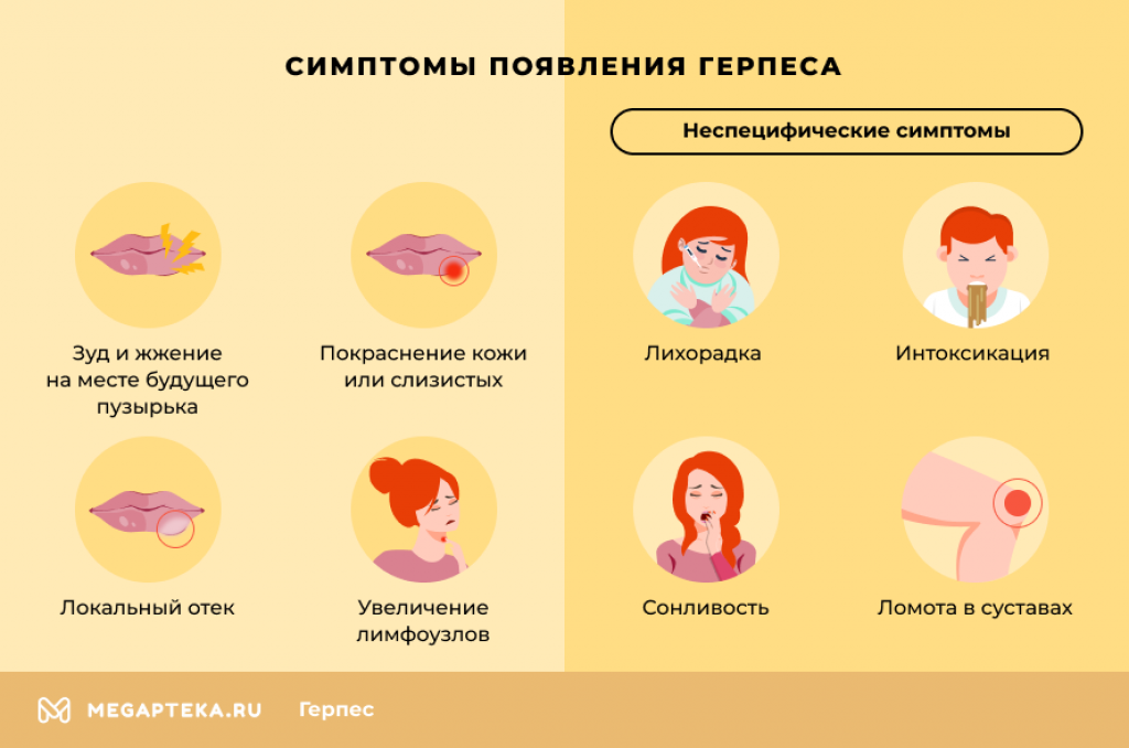 Герпес половой и на губах вызывает страшные осложнения и смерть