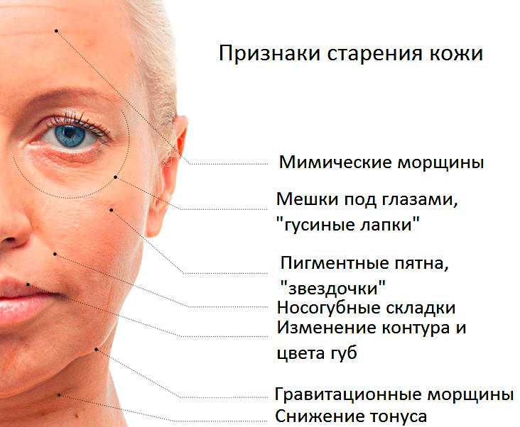 Причины раннего старения периорбитальной области