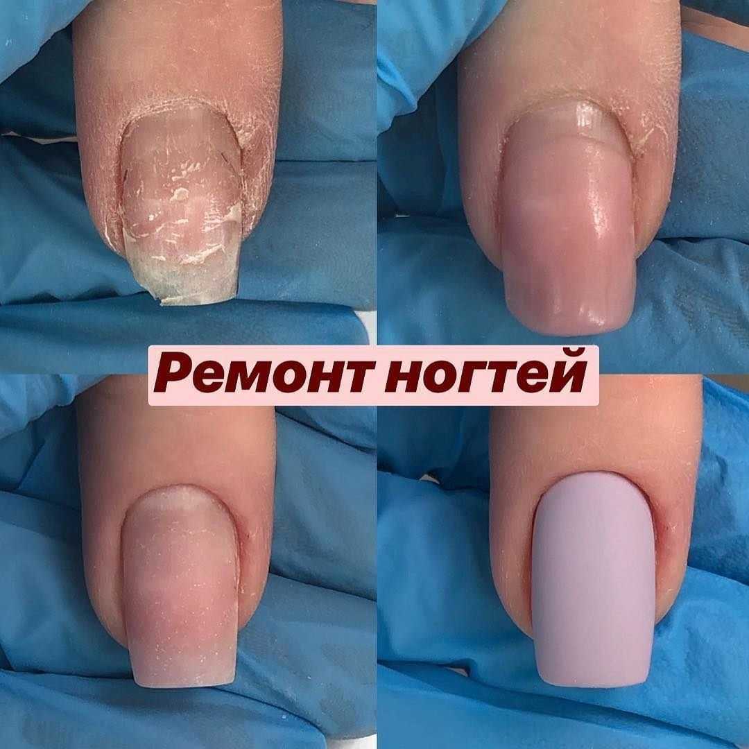 Гель лак слез на следующий день. причины