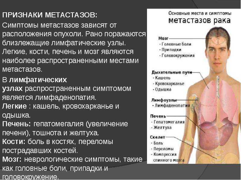 Лимфаденит: лечение воспаления лимфоузлов, симптомы, причины и последствия