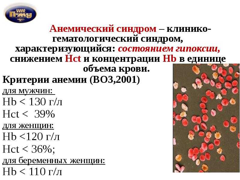 Соэ при онкологии