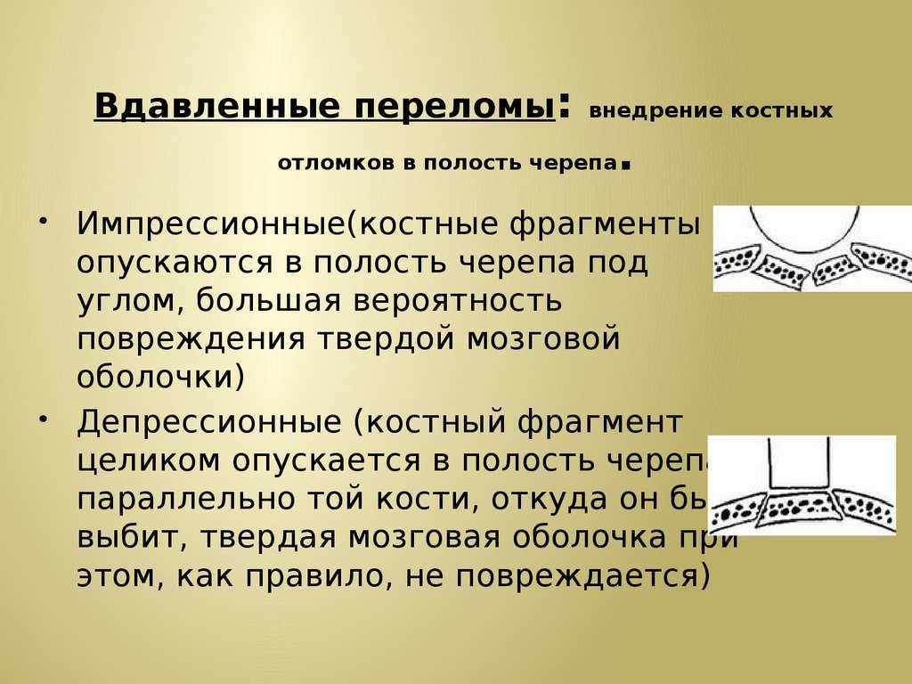 На заметку всем [если младенец упал] ак проявляется перелом черепа у ребенка томография головы младенца