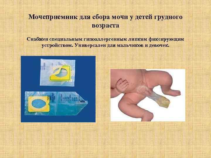 Как собрать мочу у грудничка девочки в мочеприемник, как справиться со сбором анализа у новорожденного ребенка другими способами?